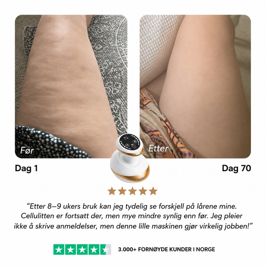 ScandiEase™ | Anti-Cellulit Massage
