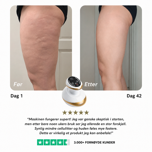 ScandiEase™ | Anti-Cellulitt Massasje